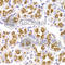 K3 antibody, A6125, ABclonal Technology, Immunohistochemistry paraffin image 