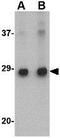 ELOVL Fatty Acid Elongase 6 antibody, GTX85403, GeneTex, Western Blot image 