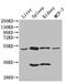 Corneodesmosin antibody, LS-C677476, Lifespan Biosciences, Western Blot image 