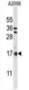 Parathymosin antibody, AP53506PU-N, Origene, Western Blot image 