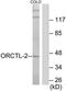 Solute carrier family 22 member 18 antibody, TA314311, Origene, Western Blot image 