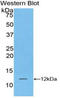 Protein S100-A5 antibody, LS-C314271, Lifespan Biosciences, Western Blot image 