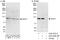 Vacuolar protein sorting-associated protein 11 homolog antibody, A303-528A, Bethyl Labs, Western Blot image 
