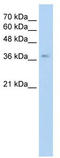 Growth Hormone Releasing Hormone Receptor antibody, TA346246, Origene, Western Blot image 