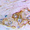Mucin 16, Cell Surface Associated antibody, LS-C356195, Lifespan Biosciences, Immunohistochemistry frozen image 