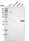 Galectin 8 antibody, HPA012734, Atlas Antibodies, Western Blot image 