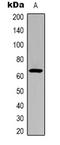 Src substrate cortactin antibody, orb339058, Biorbyt, Western Blot image 
