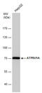 ATPase H+ Transporting V1 Subunit A antibody, GTX633542, GeneTex, Western Blot image 