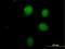 Putative Homeodomain Transcription Factor 1 antibody, H00010745-B01P, Novus Biologicals, Immunocytochemistry image 