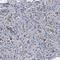 Probable ATP-dependent RNA helicase DDX41 antibody, HPA017911, Atlas Antibodies, Immunohistochemistry paraffin image 