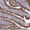 Zinc Finger Protein 891 antibody, NBP1-90894, Novus Biologicals, Immunohistochemistry paraffin image 