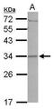Coiled-Coil Domain Containing 127 antibody, PA5-32051, Invitrogen Antibodies, Western Blot image 