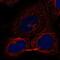 Zinc Finger DHHC-Type Containing 17 antibody, NBP1-81748, Novus Biologicals, Immunofluorescence image 