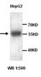 RAC-gamma serine/threonine-protein kinase antibody, orb77037, Biorbyt, Western Blot image 