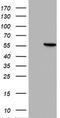 Hydroxymethylbilane Synthase antibody, TA802521BM, Origene, Western Blot image 