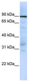 EWS RNA Binding Protein 1 antibody, TA343522, Origene, Western Blot image 
