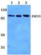 Zinc Finger Protein 25 antibody, PA5-37238, Invitrogen Antibodies, Western Blot image 