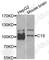 Complement C1s antibody, A6878, ABclonal Technology, Western Blot image 