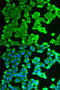 Ribosomal Protein Lateral Stalk Subunit P0 antibody, A04349, Boster Biological Technology, Western Blot image 