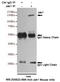 Janus Kinase 1 antibody, STJ99137, St John
