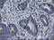 RAB30, Member RAS Oncogene Family antibody, M09855, Boster Biological Technology, Immunohistochemistry paraffin image 