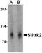 SLIT And NTRK Like Family Member 2 antibody, orb74936, Biorbyt, Western Blot image 