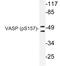 Vasodilator Stimulated Phosphoprotein antibody, LS-C178002, Lifespan Biosciences, Western Blot image 