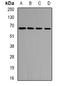 Electron transfer flavoprotein-ubiquinone oxidoreductase, mitochondrial antibody, orb341118, Biorbyt, Western Blot image 
