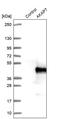 A-Kinase Anchoring Protein 7 antibody, PA5-55822, Invitrogen Antibodies, Western Blot image 
