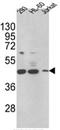 3-keto-steroid reductase antibody, AP17485PU-N, Origene, Western Blot image 