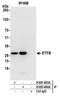 Electron transfer flavoprotein subunit beta antibody, A305-484A, Bethyl Labs, Immunoprecipitation image 