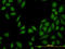 Methylthioadenosine Phosphorylase antibody, LS-C197712, Lifespan Biosciences, Immunofluorescence image 