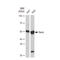 Renin antibody, GTX02842, GeneTex, Western Blot image 