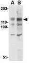 BUB1 Mitotic Checkpoint Serine/Threonine Kinase antibody, GTX31758, GeneTex, Western Blot image 