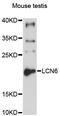 Lipocalin 6 antibody, MBS127452, MyBioSource, Western Blot image 