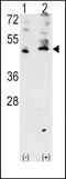 Vascular Endothelial Growth Factor C antibody, PA5-11908, Invitrogen Antibodies, Western Blot image 