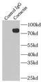 Src substrate cortactin antibody, FNab01886, FineTest, Immunoprecipitation image 