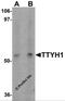 Protein tweety homolog 1 antibody, 6883, ProSci, Western Blot image 