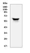 Keratin 5 antibody, A00398, Boster Biological Technology, Western Blot image 