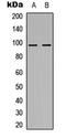 Nucleolar Protein With MIF4G Domain 1 antibody, abx121535, Abbexa, Western Blot image 