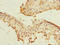 Polo Like Kinase 3 antibody, LS-C676276, Lifespan Biosciences, Immunohistochemistry paraffin image 