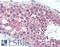 Lysosomal-associated transmembrane protein 4B antibody, LS-B15675, Lifespan Biosciences, Immunohistochemistry paraffin image 