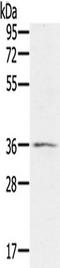 Ring Finger Protein 144B antibody, TA350073, Origene, Western Blot image 