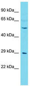 Calcium/Calmodulin Dependent Protein Kinase IV antibody, TA341838, Origene, Western Blot image 