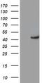 Potassium Voltage-Gated Channel Subfamily A Member Regulatory Beta Subunit 1 antibody, LS-C173541, Lifespan Biosciences, Western Blot image 