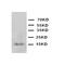 Fatty Acid Binding Protein 2 antibody, orb27670, Biorbyt, Western Blot image 