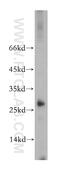 STARD3 N-Terminal Like antibody, 20502-1-AP, Proteintech Group, Western Blot image 