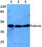 NPHS2 Stomatin Family Member, Podocin antibody, GTX66764, GeneTex, Western Blot image 