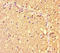 Zinc Finger And BTB Domain Containing 46 antibody, LS-C682279, Lifespan Biosciences, Immunohistochemistry paraffin image 