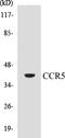 C-C Motif Chemokine Receptor 5 (Gene/Pseudogene) antibody, EKC1096, Boster Biological Technology, Western Blot image 